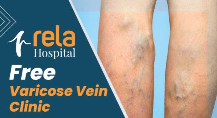 Rela Hospital Initiates Free Varicose Vein Clinic to Address Rising Cases of Chronic Leg Pain and Vein Disorders