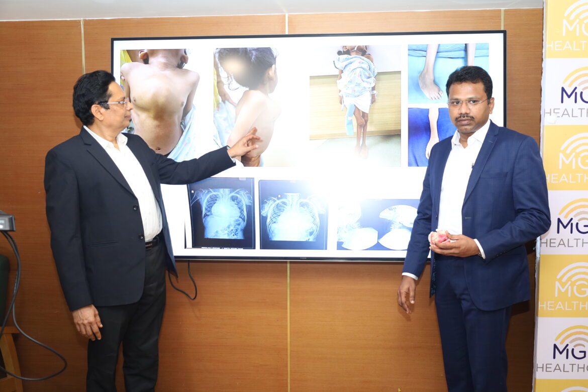 MGM Healthcare Achieves a Milestone with Complex Mitral Valve Replacement on 14-Year-Old with Rare Heart Anatomical Abnormality and Metabolic Disorder